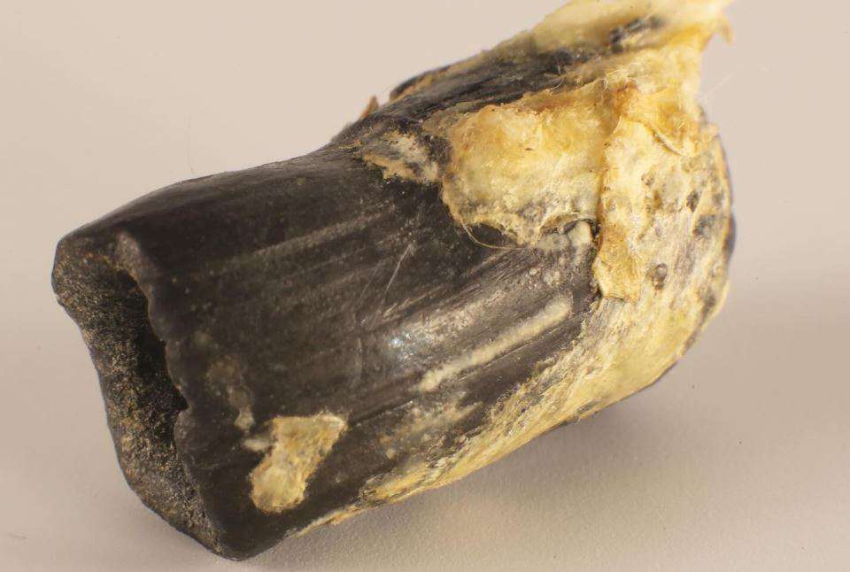 Turkish bullet in the body of an Armenian woman