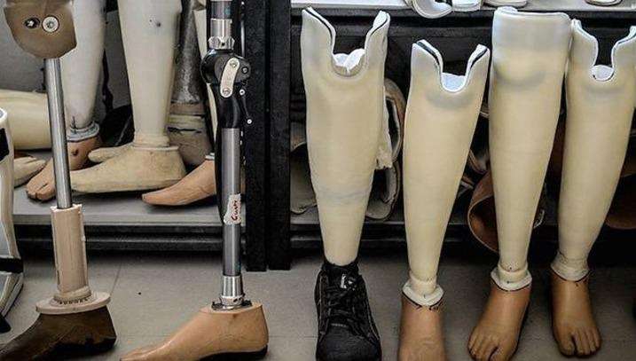 Պրոթեզների և օրթեզների շուկաներում գնային մրցակցությունը բացակայում է