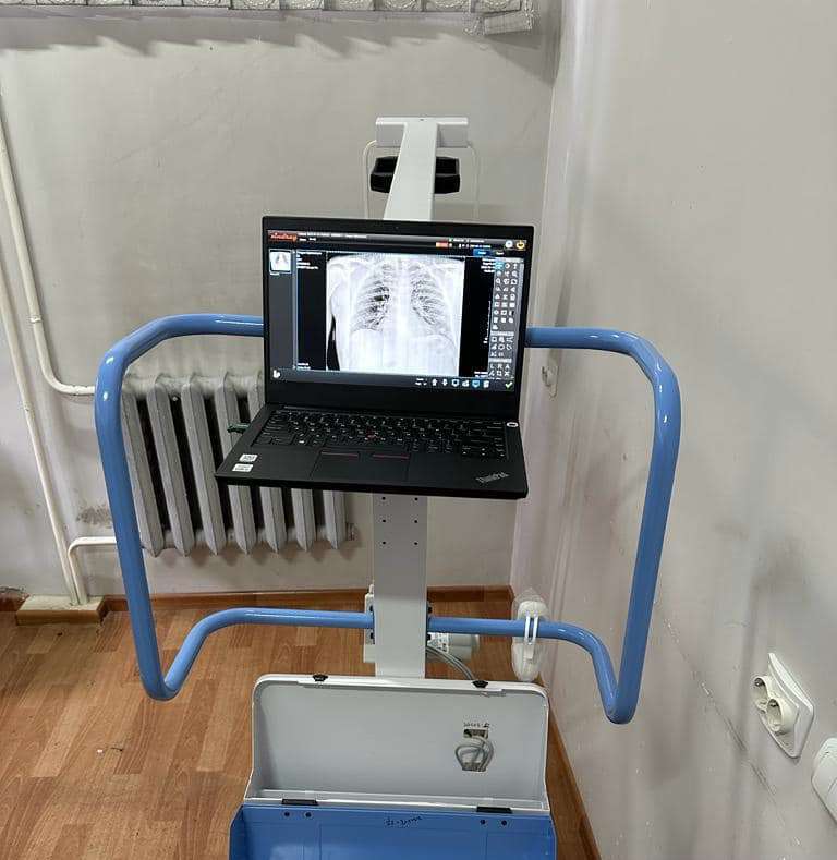 Երևանի պոլիկլինիկական ծառայությունները և շտապ օգնության ծառայությունը ապահովվել են շարժական թվային ռենտգեն սարքերով