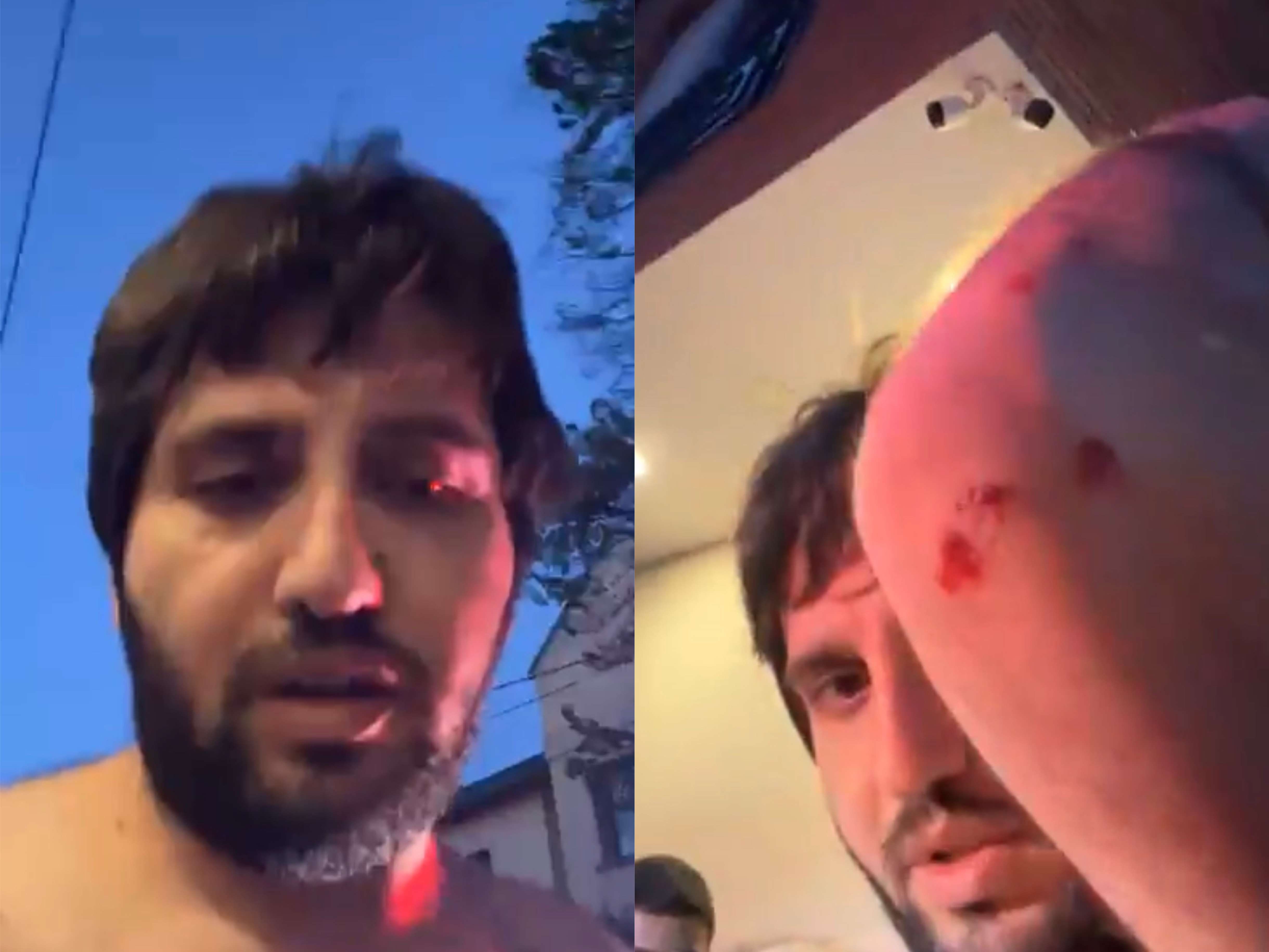 На президента армянской общины Грузии напали неизвестные в масках (видео)