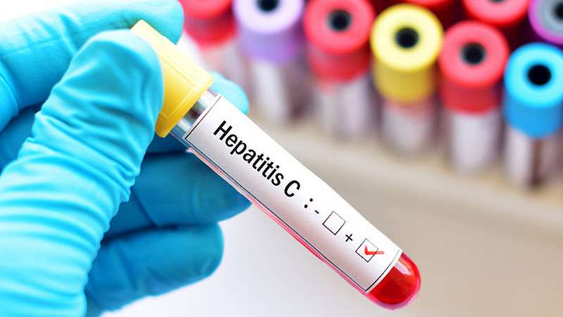 «Հեպատիտ C» ախտորոշմամբ ազատազրկված անձանց կտրամադրվի բուժման լիարժեք կուրս