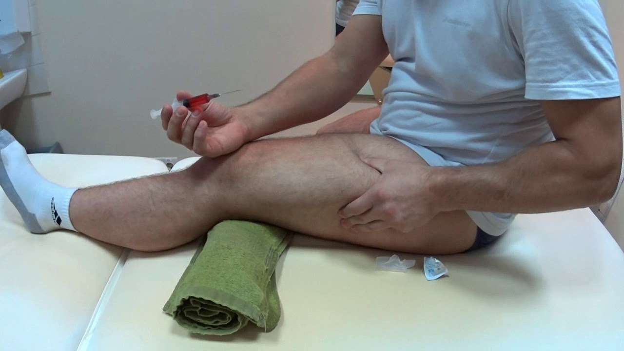 В Абовяне человек в маске уколол бедро сотруднику банка и потребовал 500 000 драмов за противоядие.