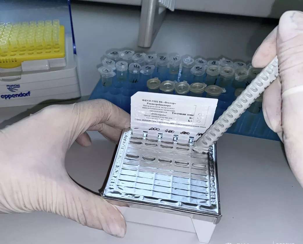 Россия предоставила Армении тесты для определения оспы обезьян