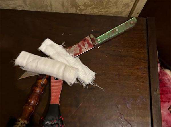 Հայտնաբերվել է 65-ամյա կնոջ դի՝ պարանոցի շրջանում կտրած վնասվածքով